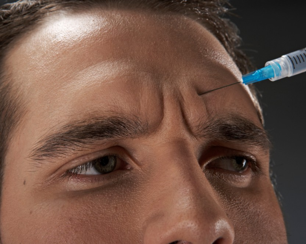 Suavização de linhas para Homens